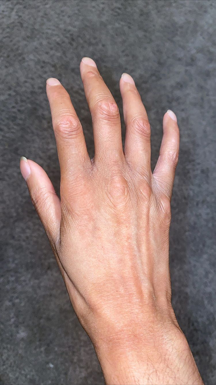 Keanna Orlang Right Hand Back