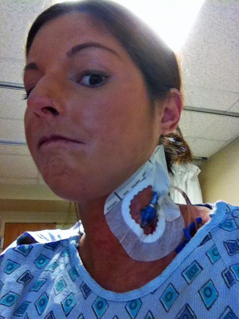 One of Amy's many treatments for scleroderma: a pic line was placed in her neck for three days