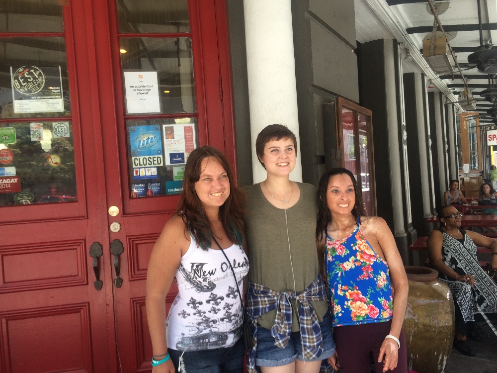 Tiaré and two friends with scleroderma