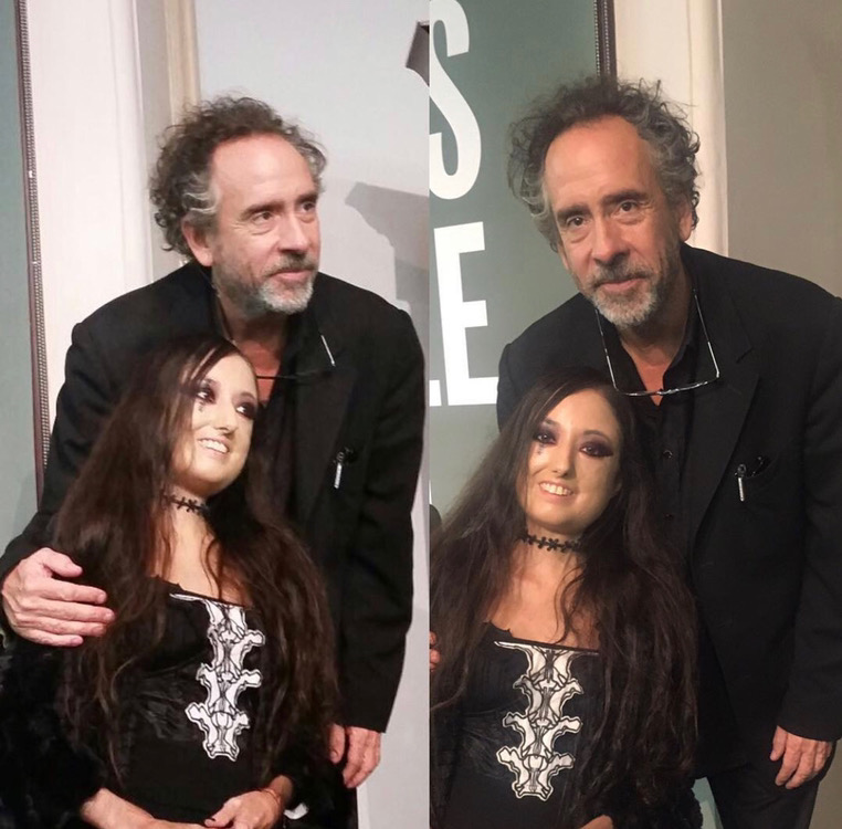 Shirley met Tim Burton, whose films help her cope and embrace her imperfection