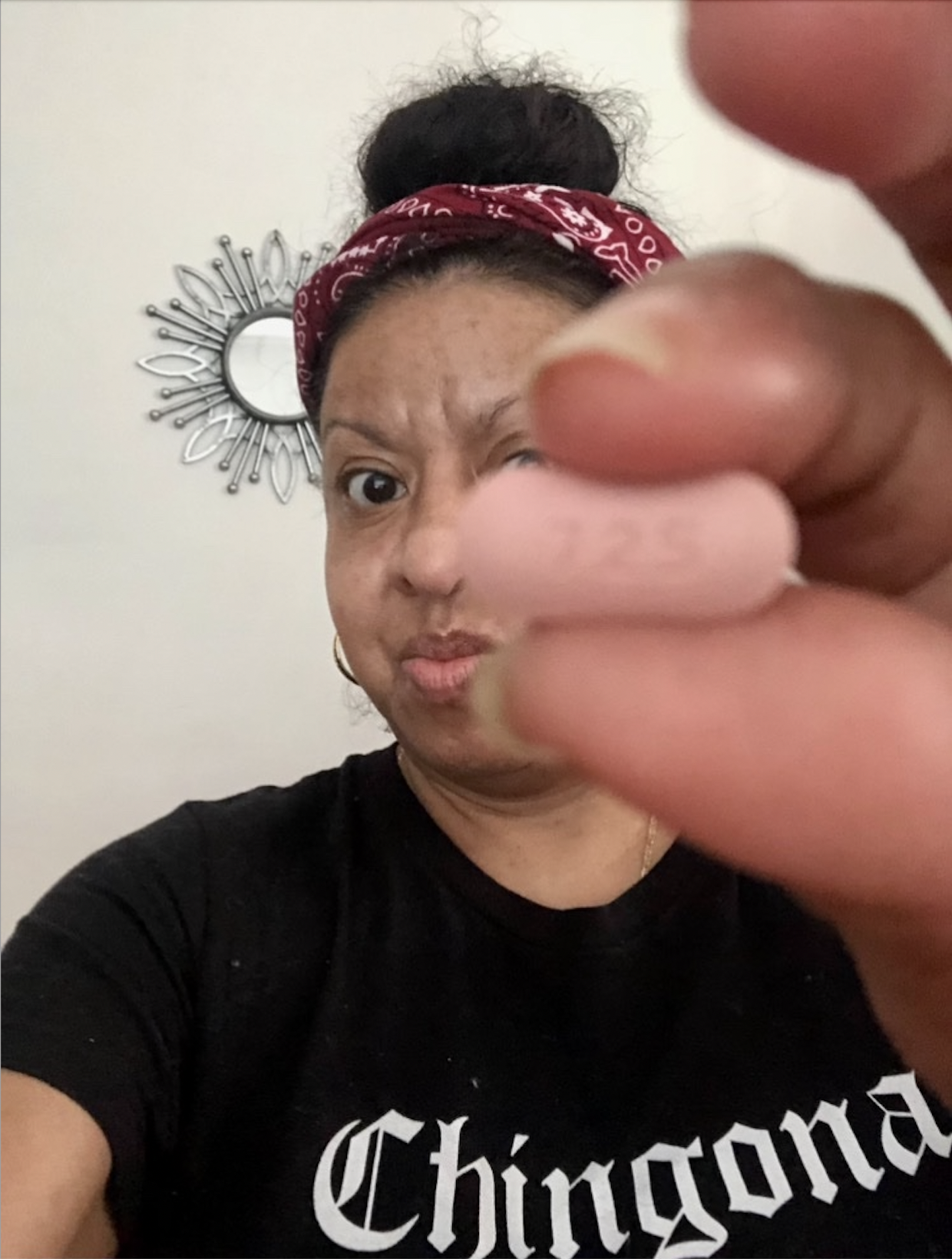 Marissa starting scleroderma treatment 